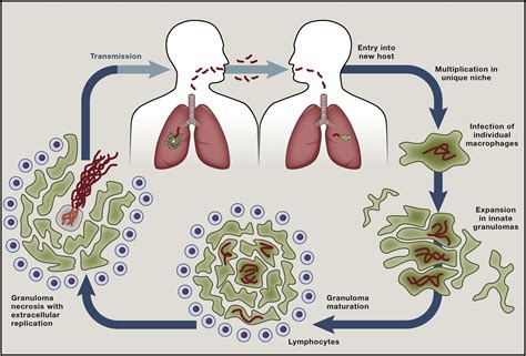 M. Tuberculosis Pathogenesis に対する画像結果