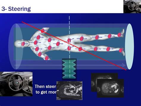 Image result for How Does MRI Work