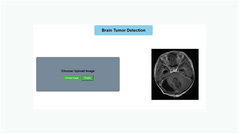 Résultat d’images pour Brain Tumor Detection Using Deep Learning
