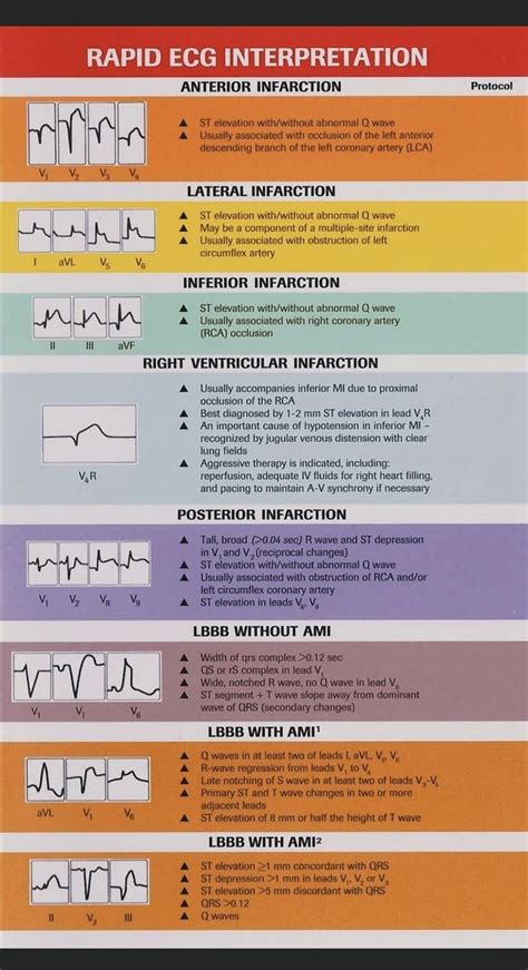 Image result for 5 Step Method ECG