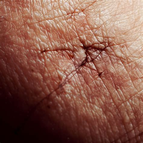 Image result for Unity Scar Texture