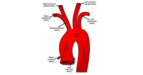 Toradh íomhá ar Common Carteroid Artery