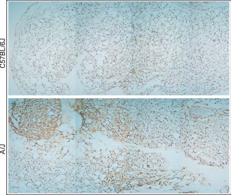 Image result for Retroperitoneal Adipose