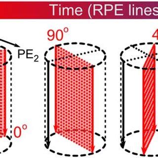 3D Image Phase Encoding MRI ପାଇଁ ପ୍ରତିଛବି ଫଳାଫଳ