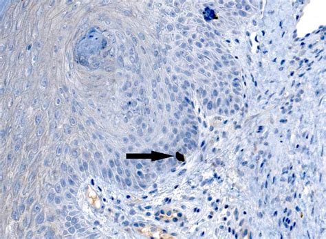 Afbeeldingsresultaten voor Merkel Cell Light Microscopy
