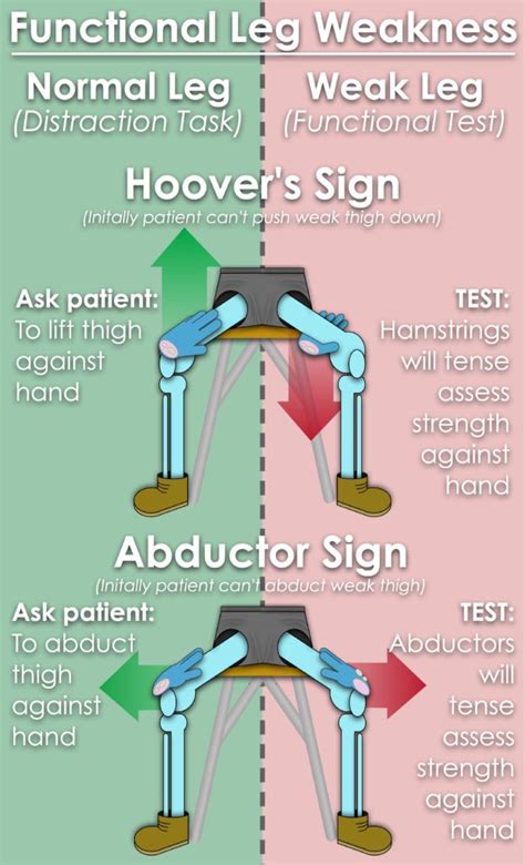 Image result for Leg. Sign Functional Movement Disorder