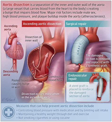 Medical Dissection に対する画像結果