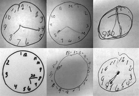 Form Mini Crog に対する画像結果