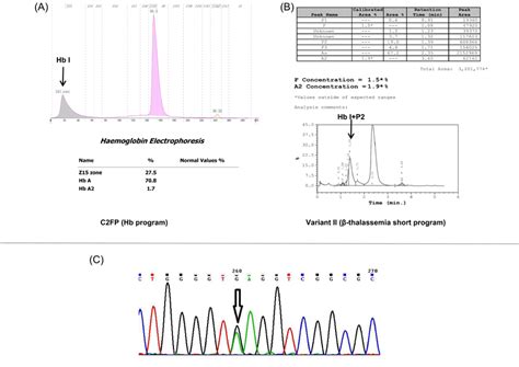 Afbeeldingsresultaten voor Bio-Rad Variant II