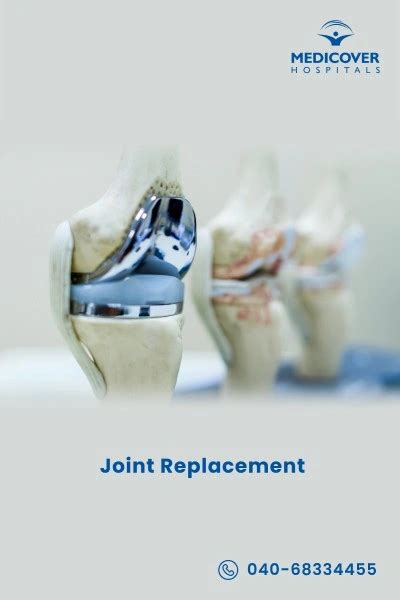 Image result for PF Joint-Replacement