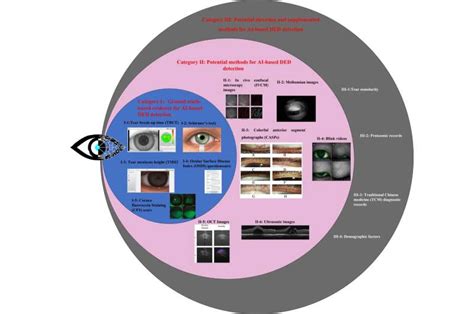 Image result for Eye Disease Detection Using Machine Learning