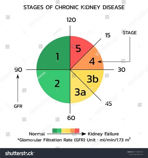 Image result for CKD Graphic