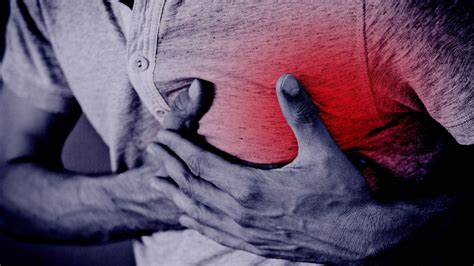 Toradh íomhá ar Stress Test Procedure