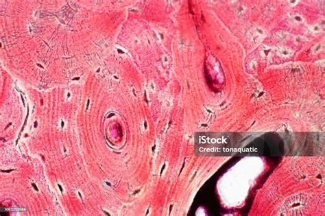 Compact Bone Tissue Slides ਲਈ ਪ੍ਰਤੀਬਿੰਬ ਨਤੀਜਾ