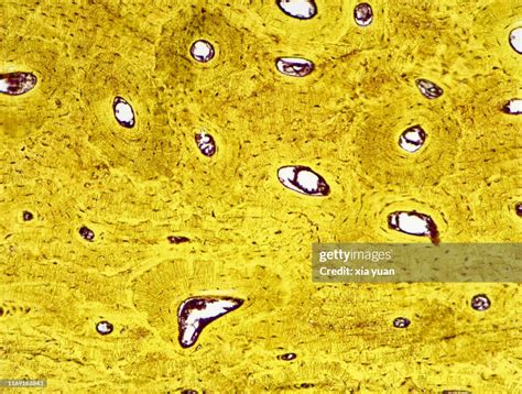 Image result for Compact Bone Under Microscope
