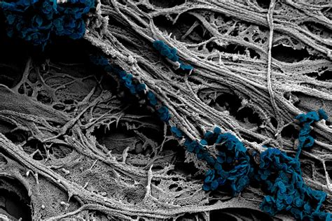 Neuron Under Electron Microscope に対する画像結果