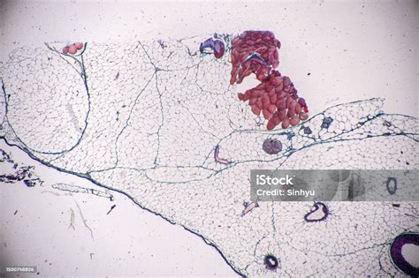 Image result for Hypophyseal Artery Under Microscope