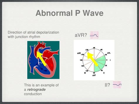 Image result for Normal R