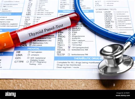 Image result for Thyroid Lab Test Form