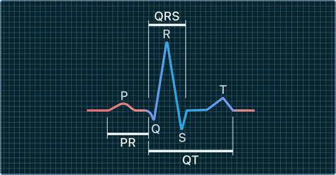Toradh íomhá ar Normal QT Interval ECG