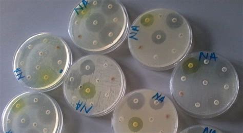 Toradh íomhá ar What Is Turbidity in Microbiology