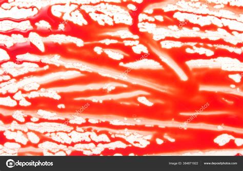 Blood Clear Background に対する画像結果