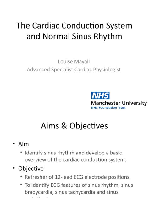 Image result for Sinus Rhythm Diagram