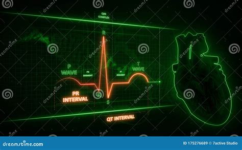 Image result for Normal ECG Intervals