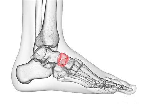 Image result for Navicular Bone Sprain