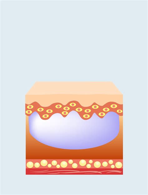 Image result for Face Dermal