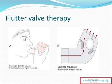 Flutter Valve Directions に対する画像結果