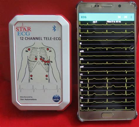 ECG Device に対する画像結果