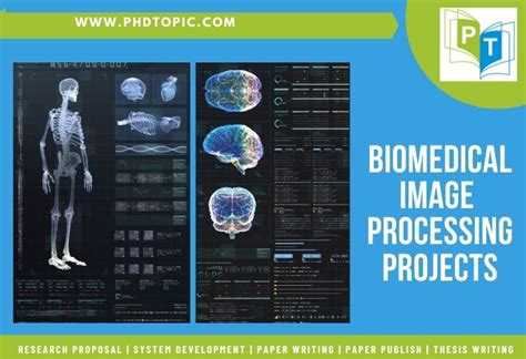 Image result for Image Processing Software for Medical
