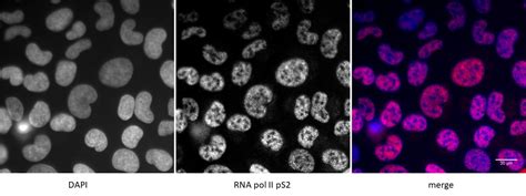 Image result for RNA Pol II ChIP-seq