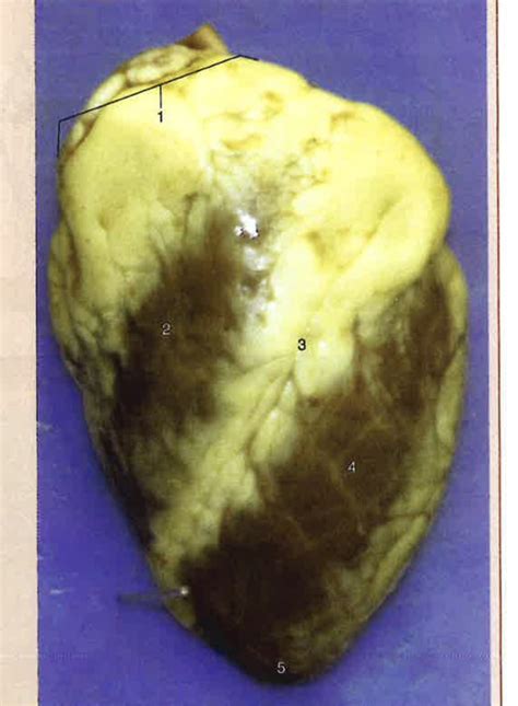 Toradh íomhá ar Metal External Structures