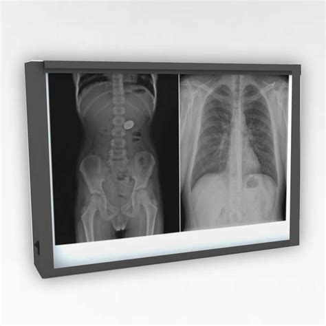 Image result for LED X-ray View Box
