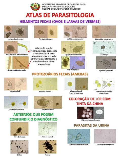 Image result for Urine Cell Atlas