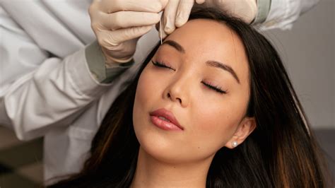 Image result for Thread Lifting Procedure