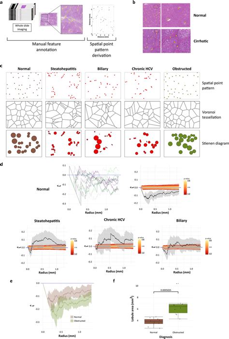 Image result for What Is a Peripheral Spatial Pattern