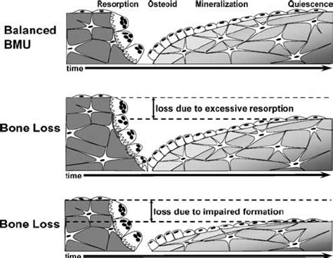 Image result for Process Bone