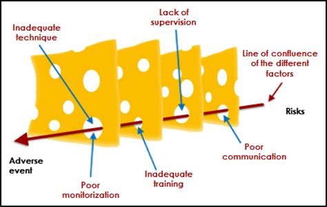 Swiss-cheese RCA に対する画像結果