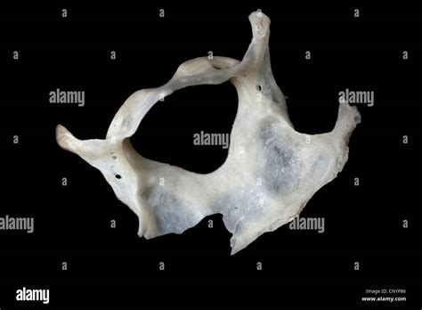 Uncus Cervical に対する画像結果