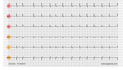 Image result for EKG Tech Practice Test