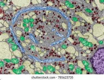 Toradh íomhá ar Electron Microscope False-Color