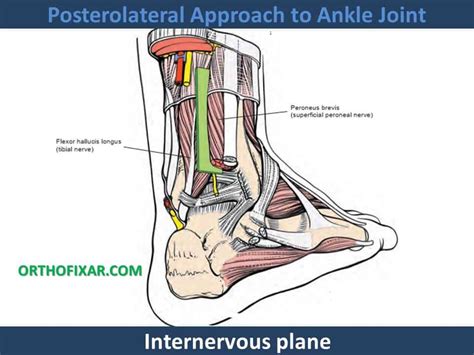Ankle Posterolateral Approach に対する画像結果