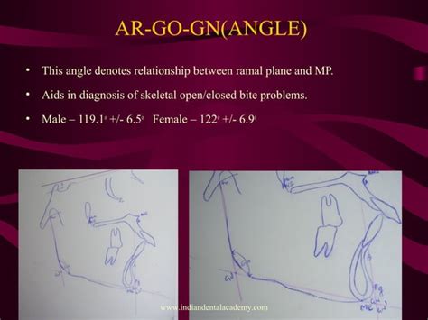 Image result for Perpendicular Cogs