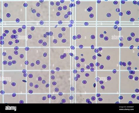 Image result for Cell Count Microscope