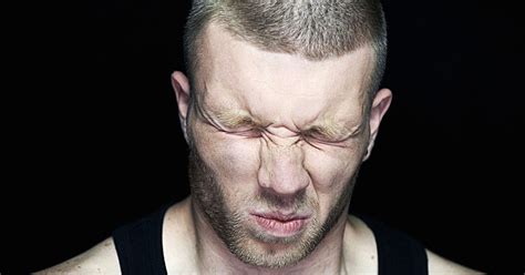 Image result for Exploding Testikals