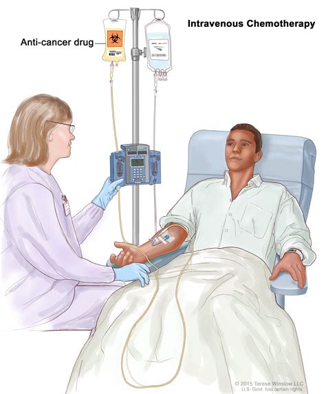 Chemotherapy Administration に対する画像結果
