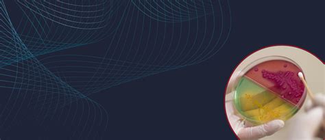 Image result for Microbiology Workflow